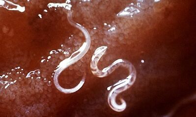 What parasites are in the hearts of humans