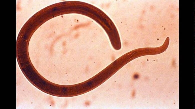 Trichinella