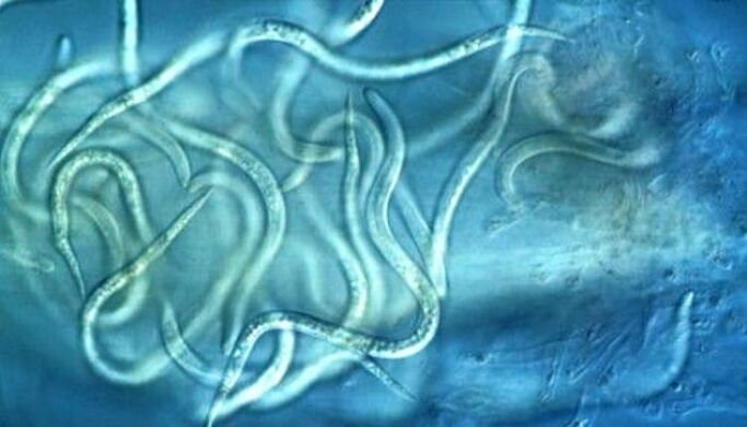 What do nematode parasites look like in the human body