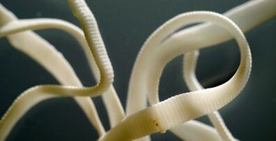 flat parasites of the human body